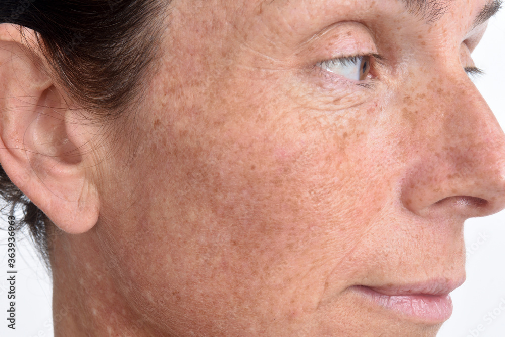 the skin of the face of a forty-five-year-old woman. the skin of the face of a forty-five-year-old woman.