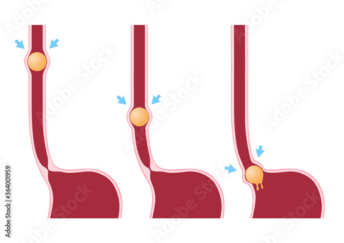Digestion and Peristalsis vector / intestine