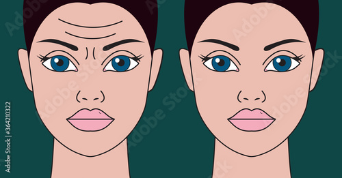 Wrinkles on womans forehead