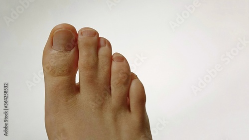 webbed toes
