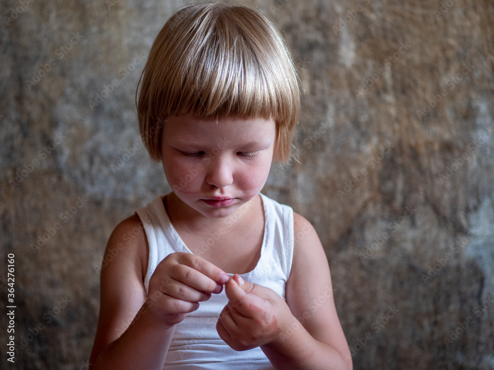 little fair-haired boy is smeared with blood. baby has weak vessels in nose bursting with pressure drops and changes in weather. Hemophilia disease. Blond child lifts his head to stop the bleeding