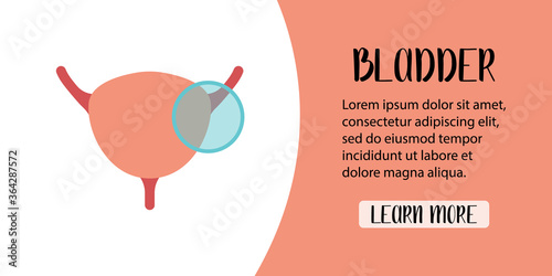 Human bladder diagnostics. Сystitis, bladder stones, cancer. Vector flat illustration. Perfect for banner, landing page, website