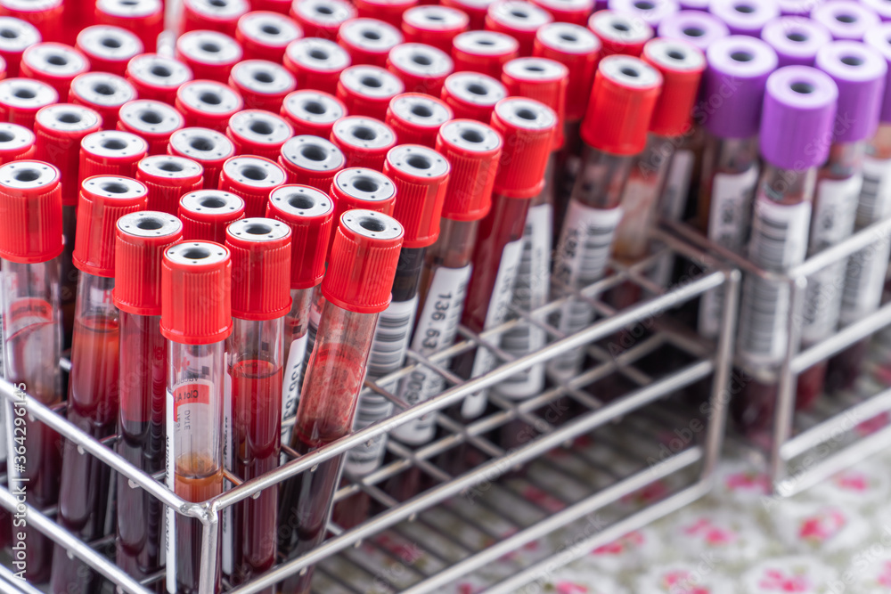 Fototapeta premium Blood test samples tubes in basket 
