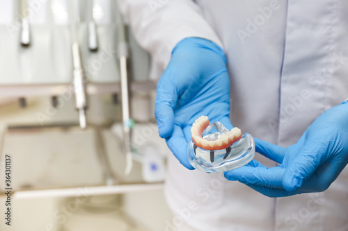 dental concept. the hands of a dentist doctor hold a model of teeth with a dental implant