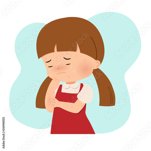 Little girl scratching her hands because of allergy. Chickenpox, pimples, acne, varicella. Contagious viral infection. Flat style vector isolated on white.