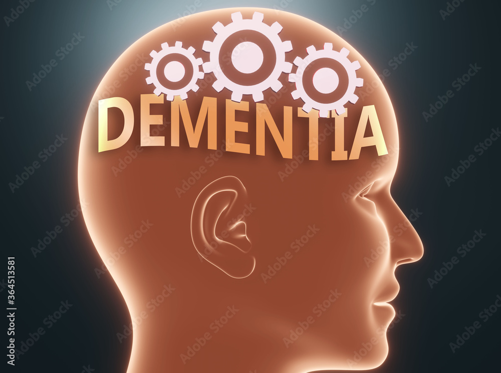 Dementia inside human mind - pictured as word Dementia inside a head with cogwheels to symbolize that Dementia is what people may think about and that it affects their behavior, 3d illustration