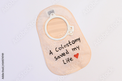A colostomy saved my life