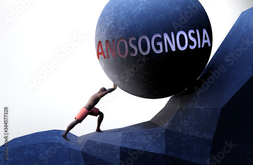 Anosognosia as a problem that makes life harder - symbolized by a person pushing weight with word Anosognosia to show that Anosognosia can be a burden that is hard to carry, 3d illustration photo