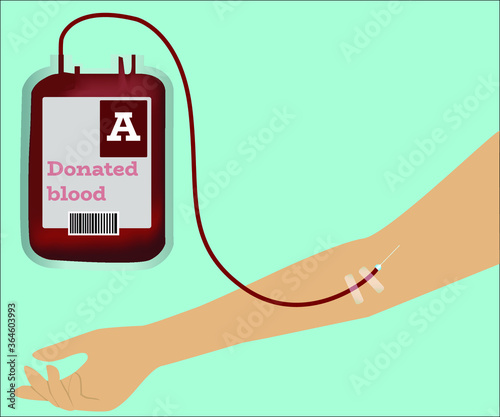 
A donor conception. A blood bag attached to the hand of a patient. Vector illustration.