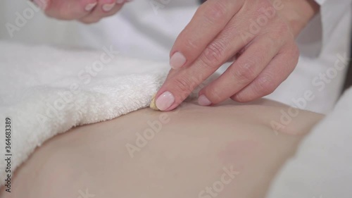 Wallpaper Mural Close-up of female hands holding moxa and putting it on female Caucasian belly. Unrecognizable doctor acupuncturist healing young woman with traditional asian medicine. Direct moxibustion. Torontodigital.ca