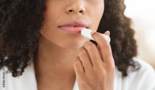 Chapped Lips Remedies. Closeup Of Black Woman Applying Chapstick Moisturizing Lip Balm