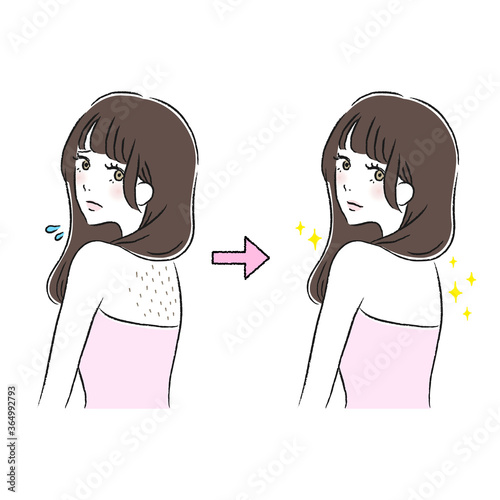 背中　ムダ毛　ケア