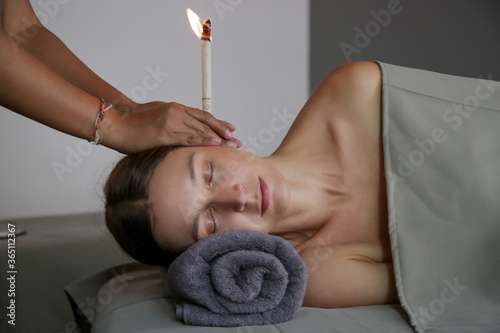Woman receiving ear candle treatment at spa. Ear coning or thermal-auricular therapy. photo