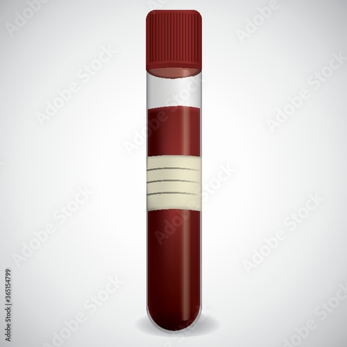 blood sample