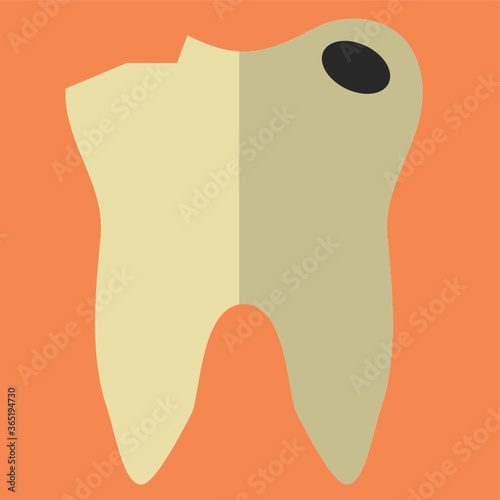 tooth with caries