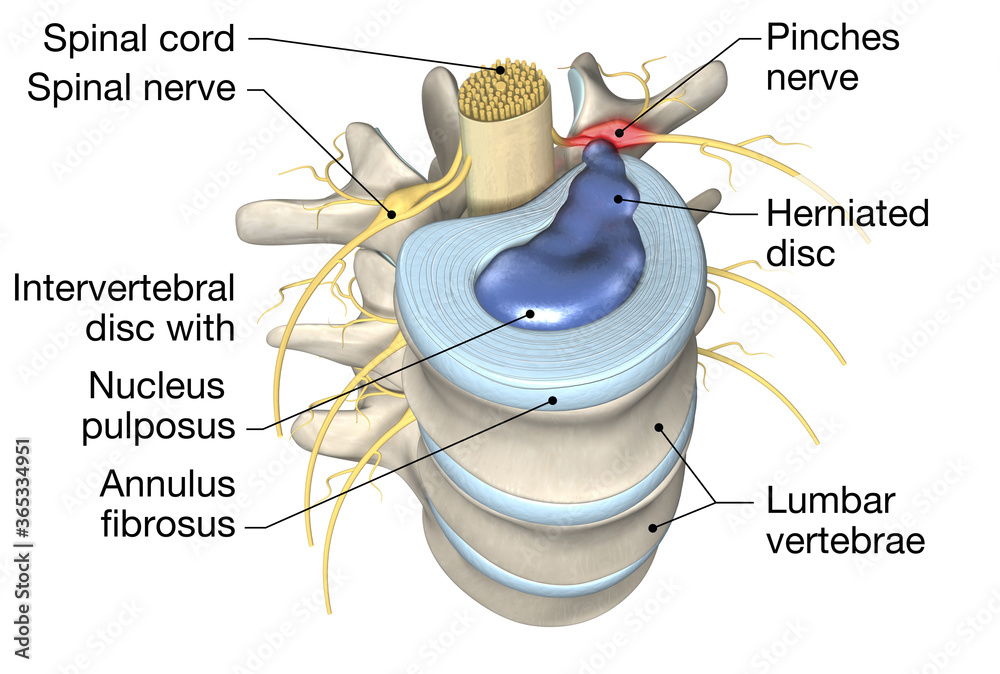 Lumbar vertebra with intervertebral disc, medically 3D illustration ilustração do Stock Adobe