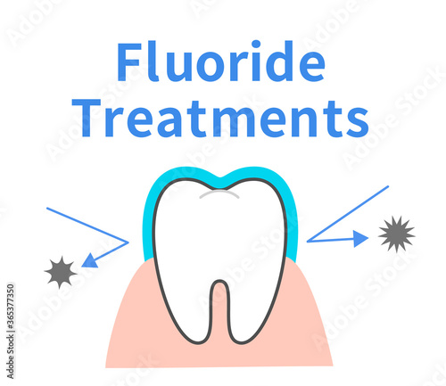 Effect of fluorine treatment Toothed character Dental illustration