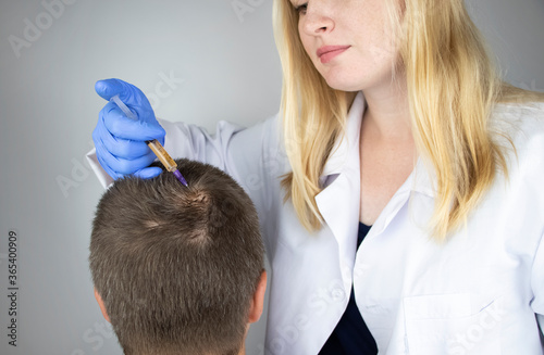 Fotografie The doctor trichologist conducts mesotherapy or plasma therapy