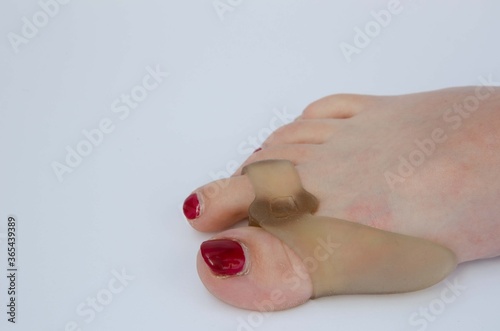 Canvastavla Woman wearing a silicone instep on her big toe