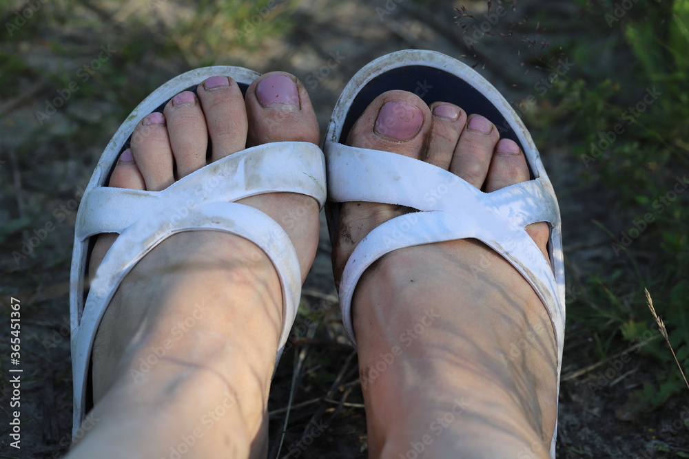 dirty feet in flip-flops summer in the country, mangy pedicure Stock Photo  | Adobe Stock