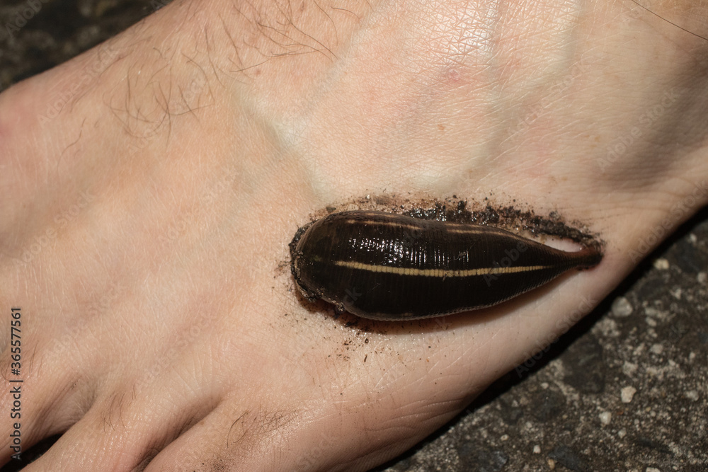 Obraz premium Leech attached to a persons foot