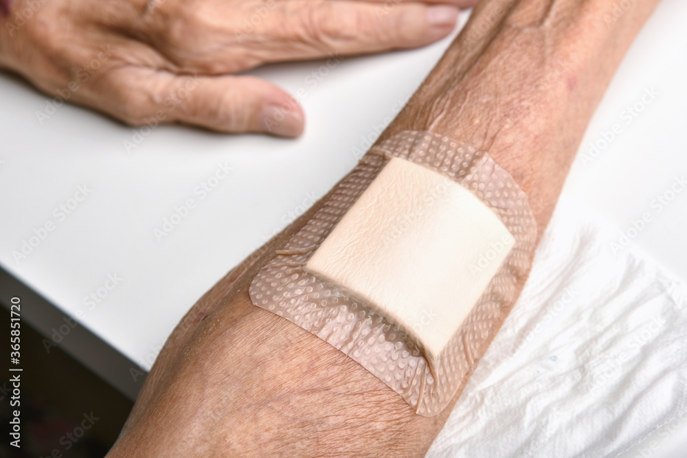 Wound bandage, Dressing arm wound with sterile plaster pad, Accidental wound  care treatment in elder old man. Photos | Adobe Stock