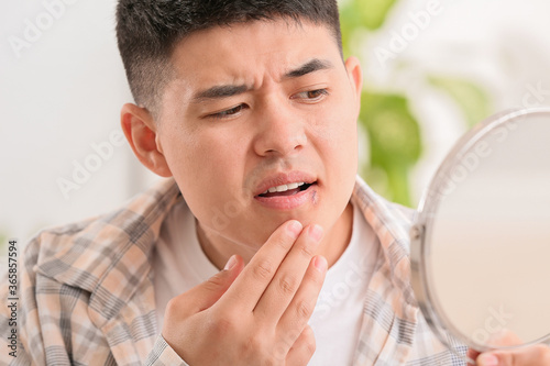 Asian man with cold sore lo...