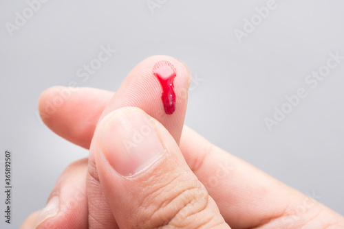 Bleeding blood from the cut finger wound. Injured finger with bleeding open cut wound. Closeup of finger human hand is cut hurt bleeding with bright red blood.  photo