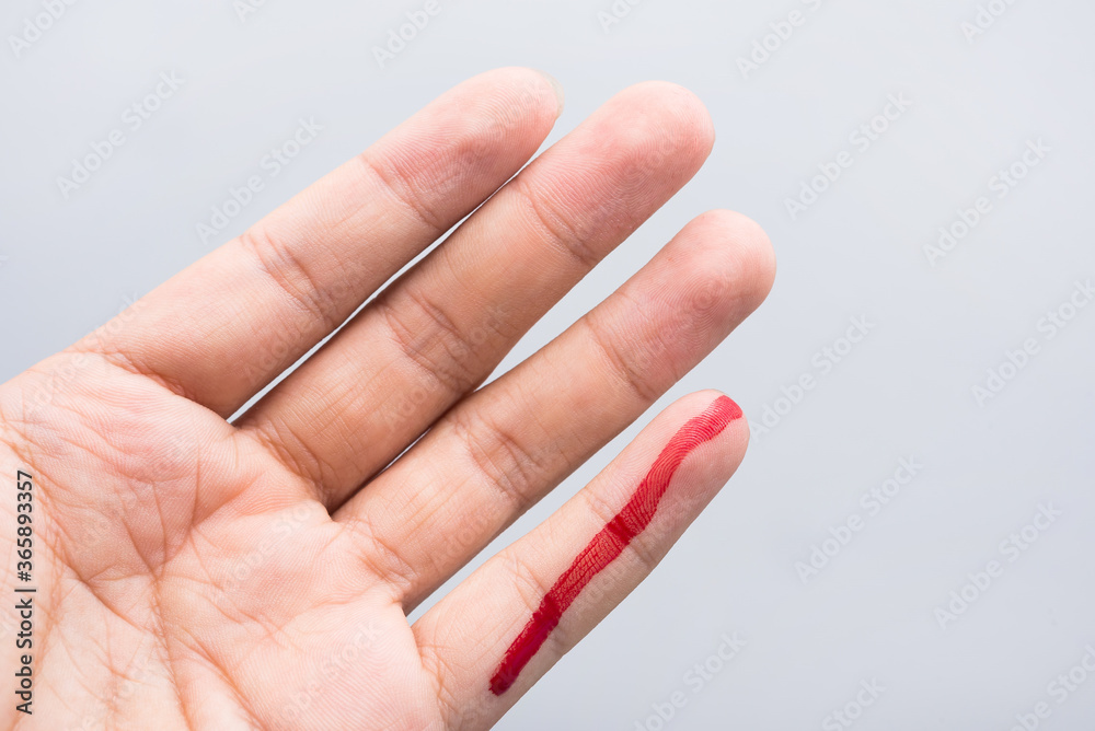 Bleeding blood from the cut finger wound. Injured finger with bleeding