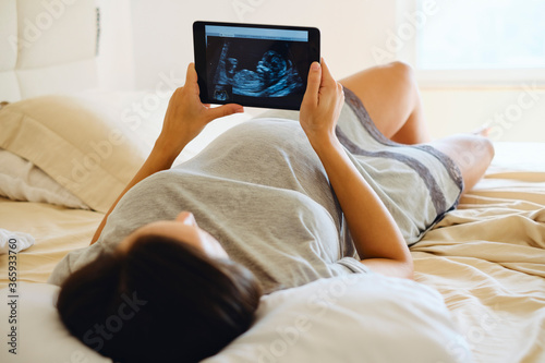Pregnant Woman Looking at Medical Baby Scan on Tablet