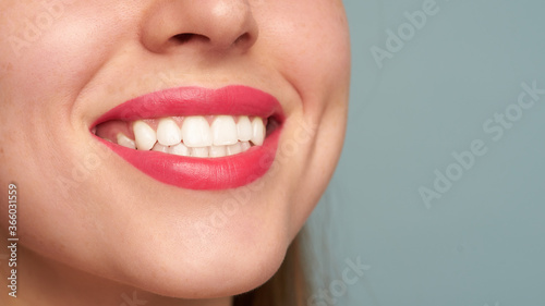 Perfect smile after bleaching. Dental care and teeth whitening. Dentistry and cosmetics. 