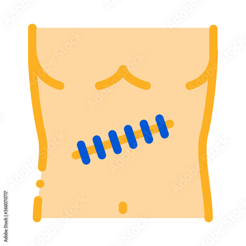 stitched surgical wound icon vector. stitched surgical wound sign. color symbol illustration