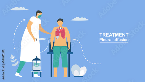Pleural effusion is collection of excess fluid between layers of pleura outside lungs. Pulmonology vector illustration about restrictive lung disease.