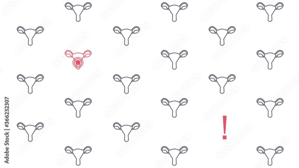 Uterus pattern cartoon animation for cervical cancer awareness. Women health screening concept motion graphics. Ovarian disease female medical diagnostic checkup. Uterus pattern cartoon animation for cervical cancer awareness. Women health screening concept motion graphics. Ovarian disease female medical diagnostic checkup.