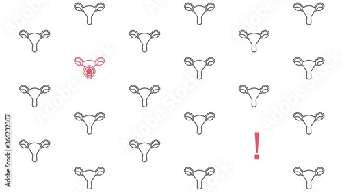 Uterus pattern cartoon animation for cervical cancer awareness. Women health screening concept motion graphics. Ovarian disease female medical diagnostic checkup. 