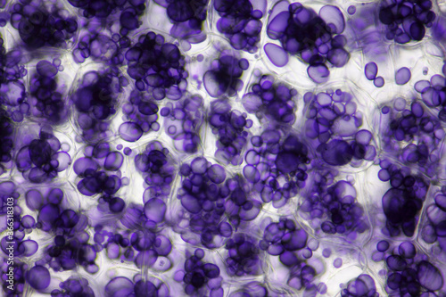 Microscopic view of a potato starch in potato tuber cells. Iodine stain. Brightfield illumination. photo