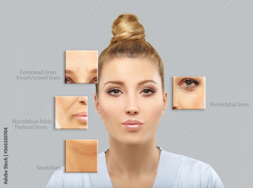 Effects of ageing,Frown/scowl lines ,Nasolabial folds,Neck ,Under eye