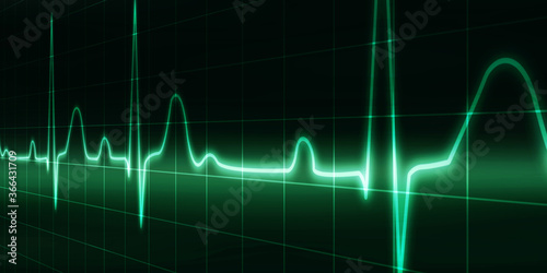 Heart with cardiogram - 2D illustration

