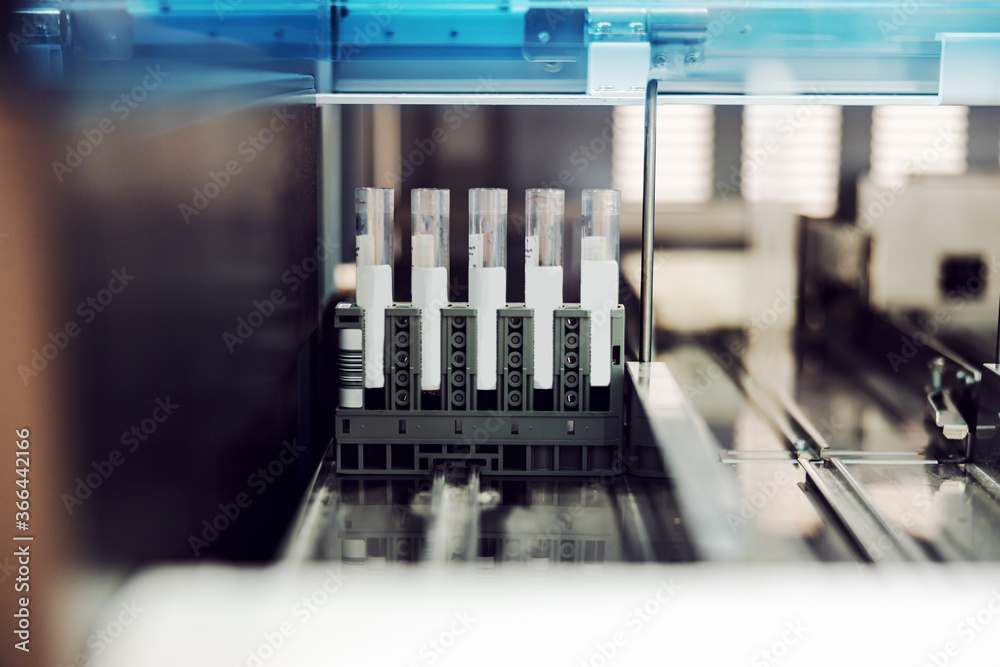 Picture of test tubes with blood samples. Picture of test tubes with blood samples.