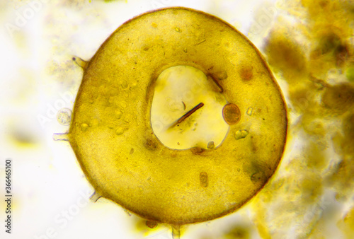 Microscopic view of testate amoeba (Centropyxis aculeata) shell. Brightfield illumination. photo
