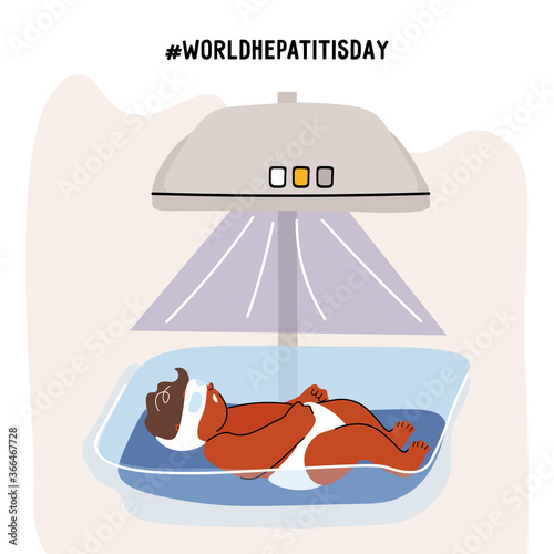 World Hepatitis Day. Phototherapy of newborns for hepatitis. Newborn in a special box under a phototherapy lamp. Vector flat illustration in cartoon style with hashtag from World Health Organization.