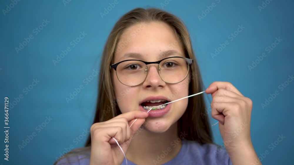 Girl with braces brushing your teeth with dental floss. A girl with colored braces on her teeth keeps her teeth clean. Girl with braces brushing your teeth with dental floss. A girl with colored braces on her teeth keeps her teeth clean.