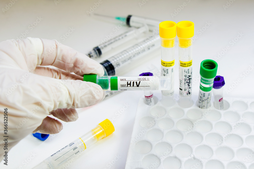 Fototapeta premium Hiv and aids infection test, doctors face and hand holding tube with blood on the blue background.