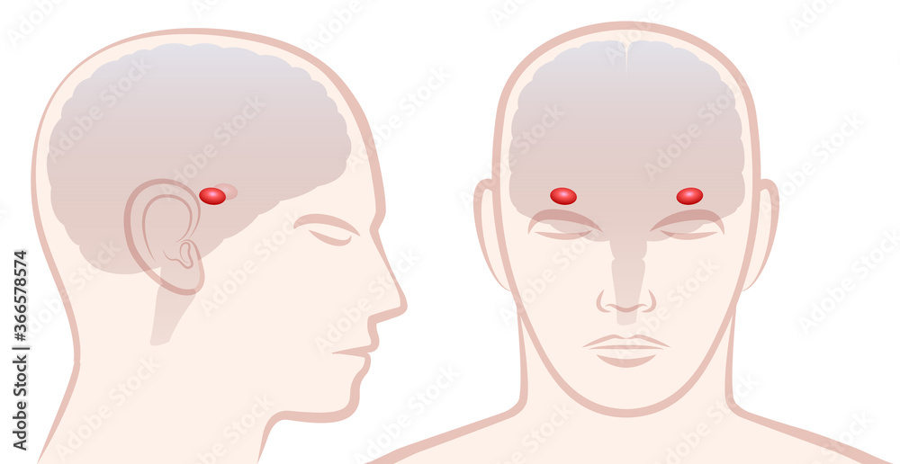 Amygdala. Profile and frontal view with location of pair of amigdalas in a human brain. Isolated vector illustration on white background.
Amygdala. Profile and frontal view with location of pair of amigdalas in a human brain. Isolated vector illustration on white background.
