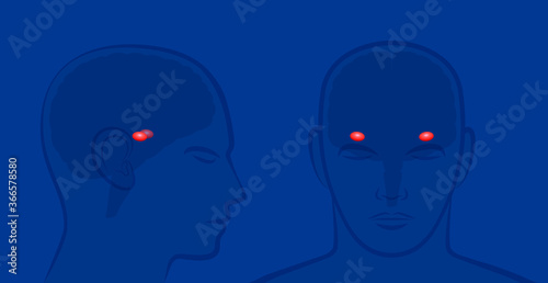 Amygdalas in a human brain. Lateral and frontal view with position of amygdalae. Vector illustration on blue background.
 photo