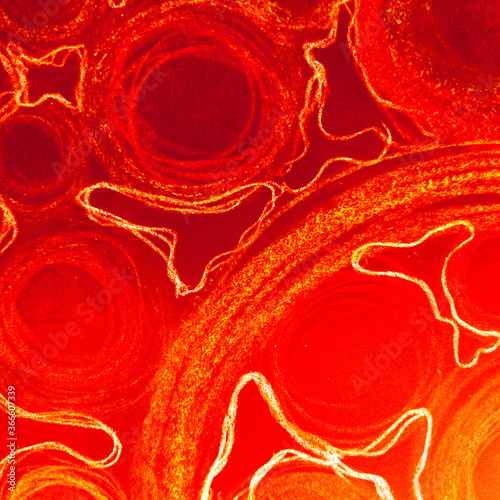 Cancer Cells Transparent. Bloodcell Orbit Energy