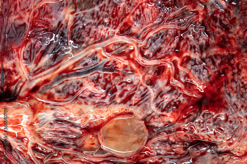 Placenta Organ