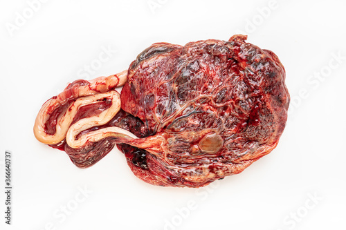 Placenta Organ