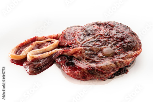 Placenta Organ