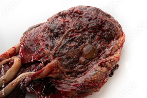 Placenta Organ